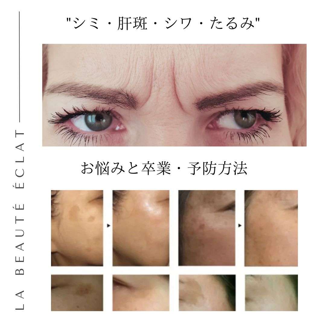 美肌再生ドクターピュールボーテ美人