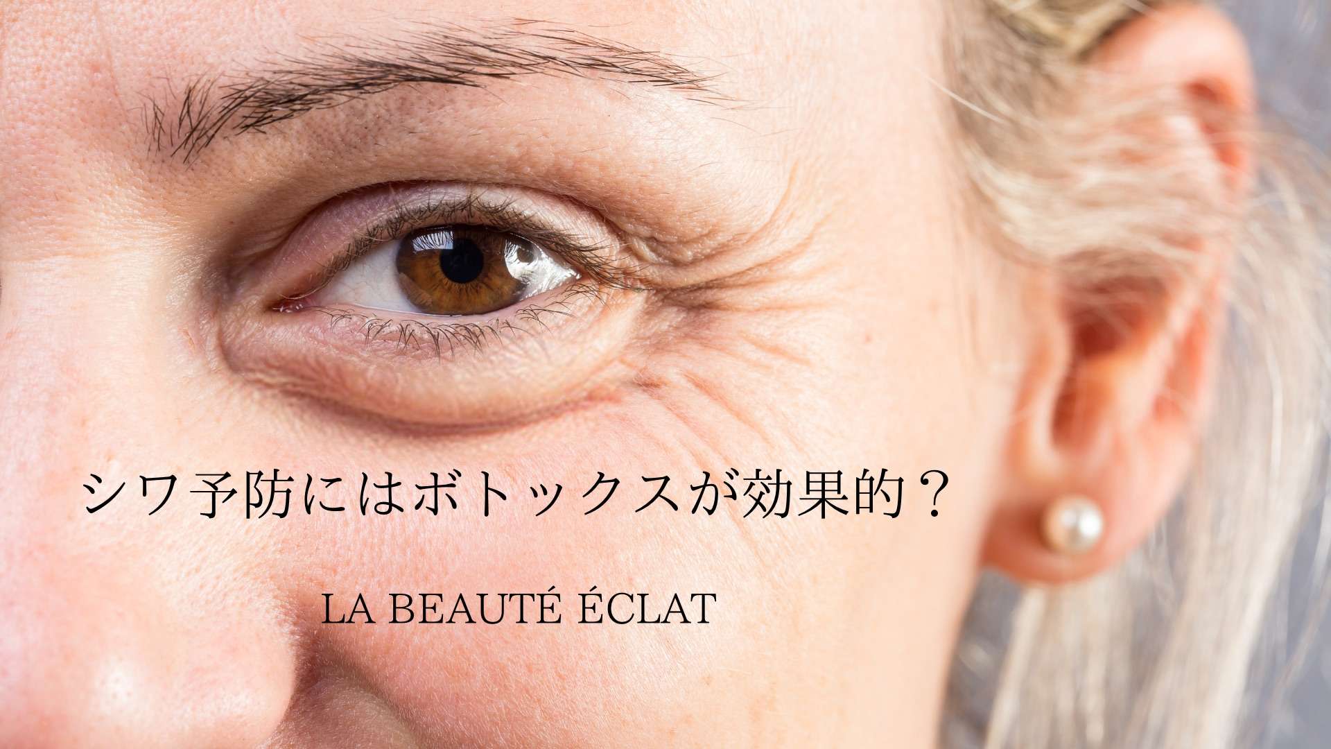 シワ予防にはボトックスが効果的？