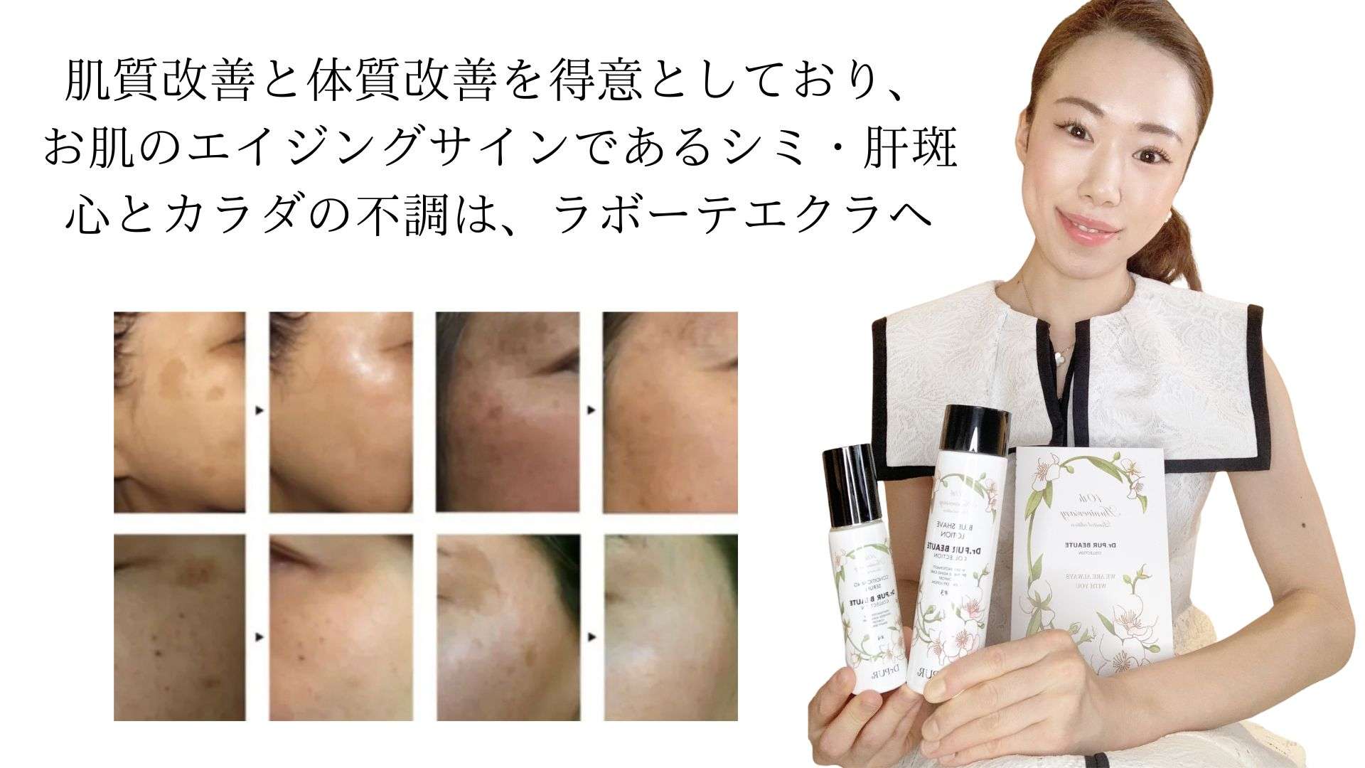 シミや肝斑の改善にはメラノサイトに働きかけるハイドロキノン以外の選択肢はない！