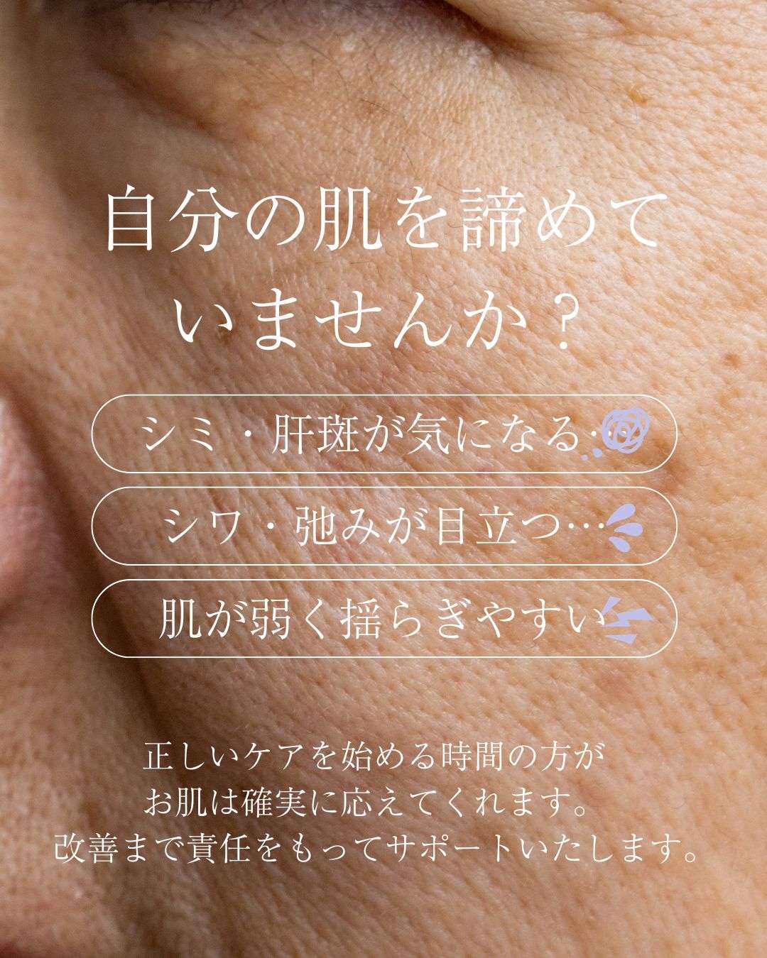 【大阪・本町】レチノールの効果が出ない50代へ｜肌が変わる“正しい使い方”と土台づくり